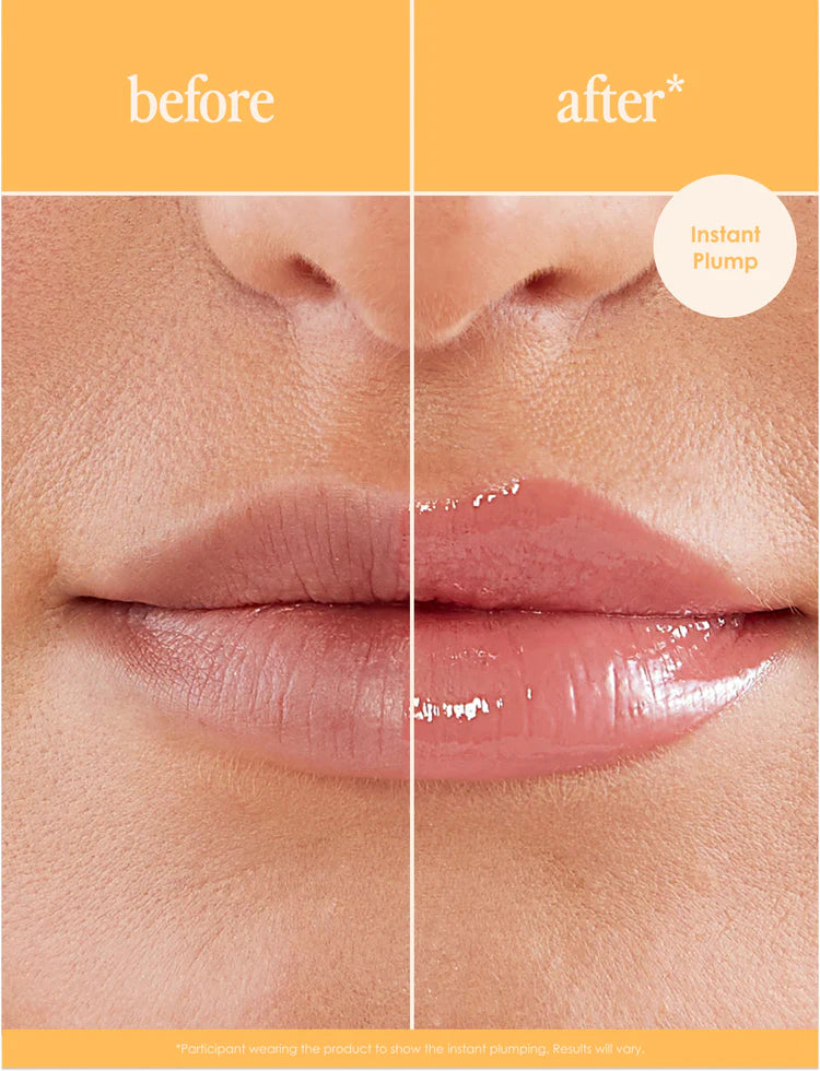 How to Get Plumper Lips Naturally: Tips for a Perfect Pout