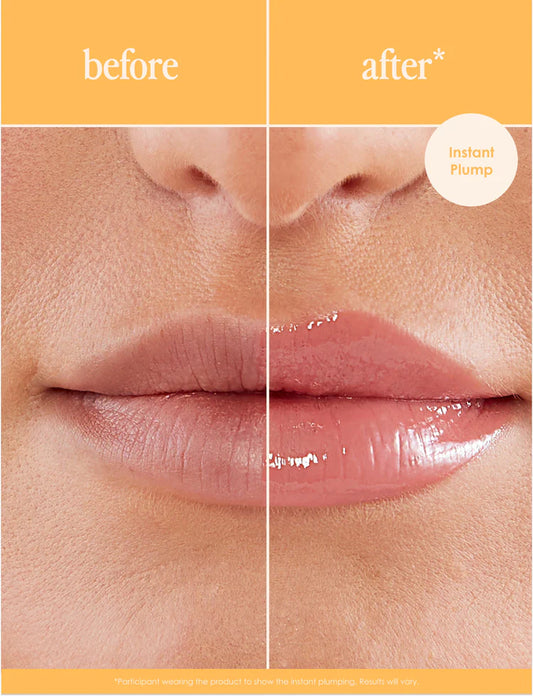 How to Get Plumper Lips Naturally: Tips for a Perfect Pout